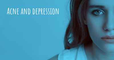 Acne and depression