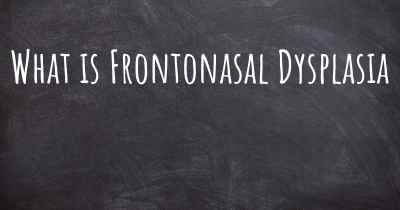 What is Frontonasal Dysplasia
