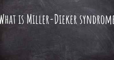 What is Miller-Dieker syndrome
