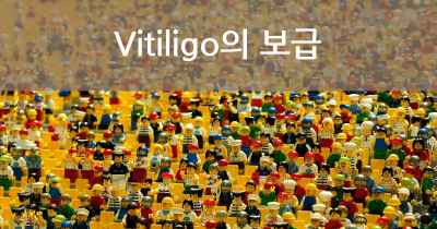 Vitiligo의 보급