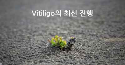 Vitiligo의 최신 진행