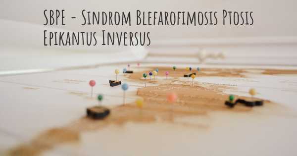 SBPE - Sindrom Blefarofimosis Ptosis Epikantus Inversus