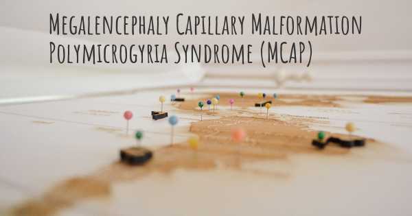 Megalencephaly Capillary Malformation Polymicrogyria Syndrome (MCAP)