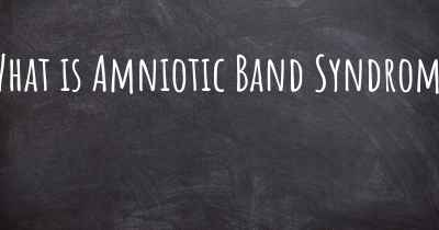 What is Amniotic Band Syndrome