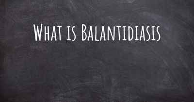 What is Balantidiasis