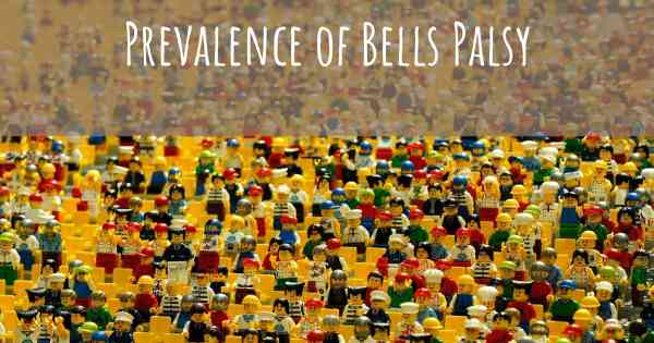Prevalence of Bells Palsy