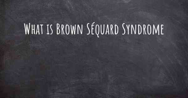 What is Brown Séquard Syndrome