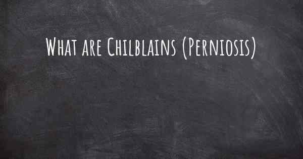 What are Chilblains (Perniosis)