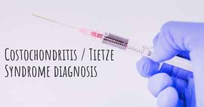 Costochondritis / Tietze Syndrome diagnosis