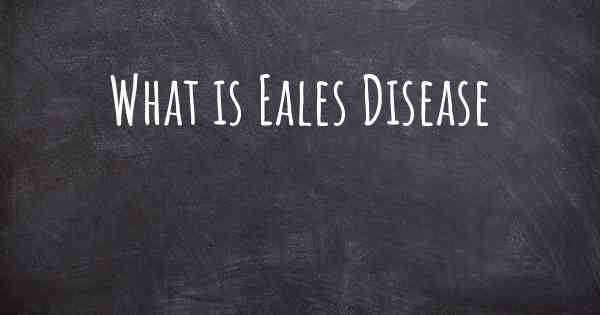 What is Eales Disease