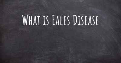 What is Eales Disease