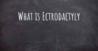 What is Ectrodactyly