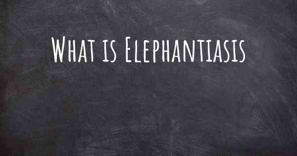 What is Elephantiasis
