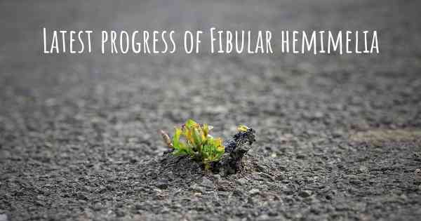 Latest progress of Fibular hemimelia