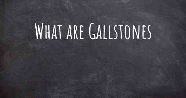 What are Gallstones