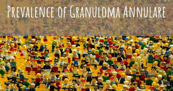 Prevalence of Granuloma Annulare
