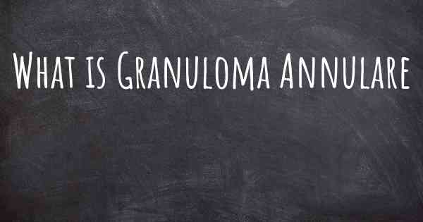 What is Granuloma Annulare