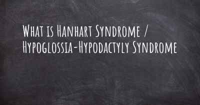 What is Hanhart Syndrome / Hypoglossia-Hypodactyly Syndrome