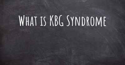 What is KBG Syndrome