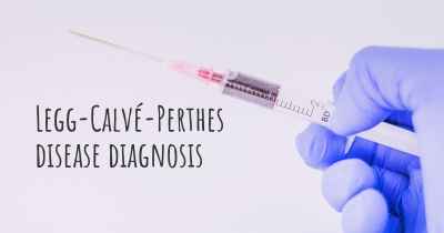 Legg-Calvé-Perthes disease diagnosis
