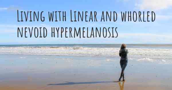 Living with Linear and whorled nevoid hypermelanosis