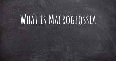 What is Macroglossia