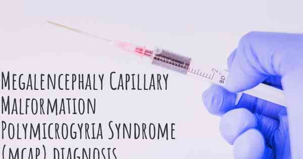 Megalencephaly Capillary Malformation Polymicrogyria Syndrome (mcap) diagnosis