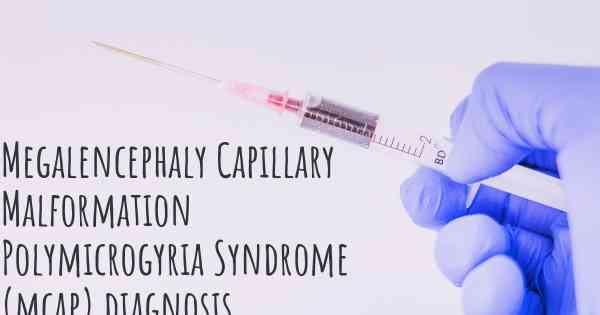 Megalencephaly Capillary Malformation Polymicrogyria Syndrome (mcap) diagnosis