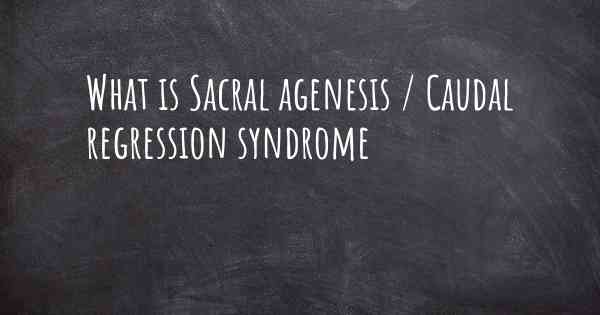 What is Sacral agenesis / Caudal regression syndrome