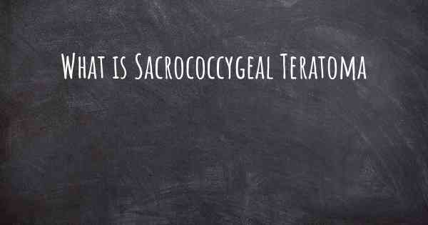 What is Sacrococcygeal Teratoma