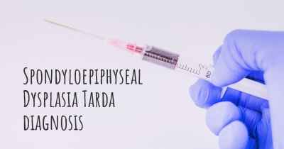 Spondyloepiphyseal Dysplasia Tarda diagnosis