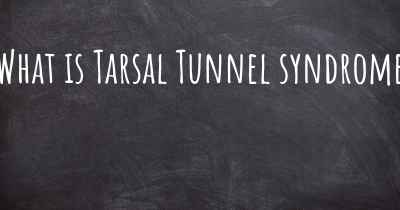 What is Tarsal Tunnel syndrome