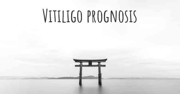 Vitiligo prognosis