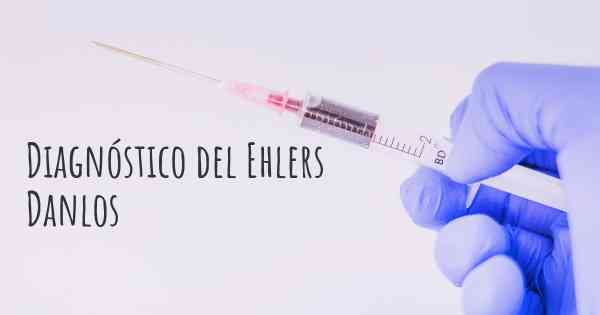 Diagnóstico del Ehlers Danlos