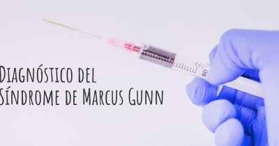 Diagnóstico del Síndrome de Marcus Gunn
