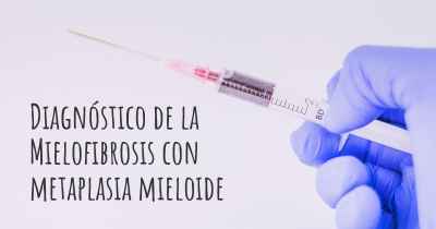 Diagnóstico de la Mielofibrosis con metaplasia mieloide