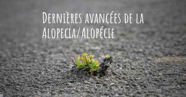 Dernières avancées de la Alopecia/Alopécie