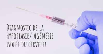 Diagnostic de la Hypoplasie/ Agénésie isolée du cervelet