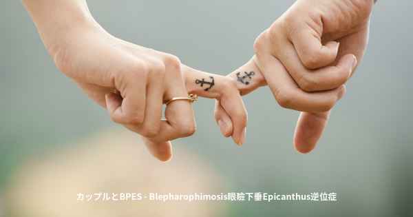 カップルとBPES - Blepharophimosis眼瞼下垂Epicanthus逆位症