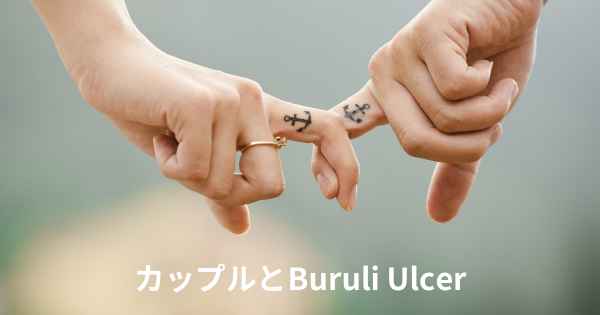 カップルとBuruli Ulcer