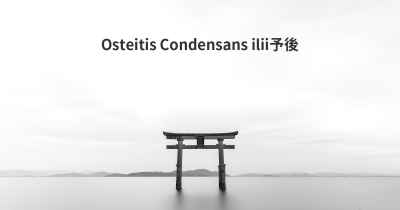 Osteitis Condensans ilii予後