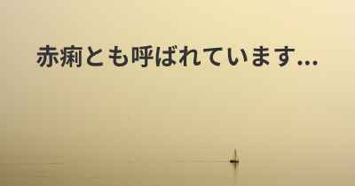 赤痢とも呼ばれています...