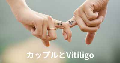 カップルとVitiligo