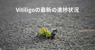 Vitiligoの最新の進捗状況