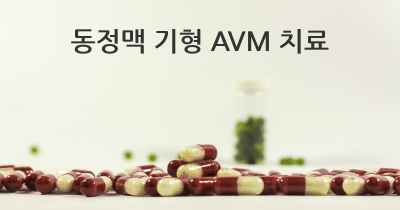 동정맥 기형 AVM 치료