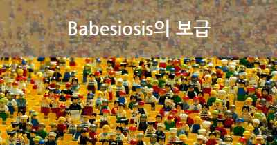 Babesiosis의 보급