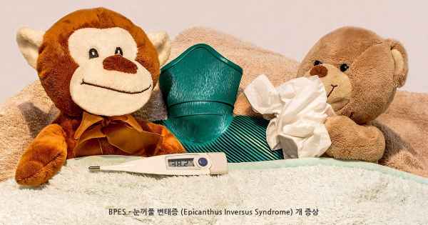 BPES - 눈꺼풀 변태증 (Epicanthus Inversus Syndrome) 개 증상