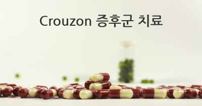 Crouzon 증후군 치료