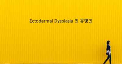 Ectodermal Dysplasia 인 유명인