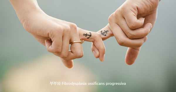 부부와 Fibrodysplasia ossificans progressiva